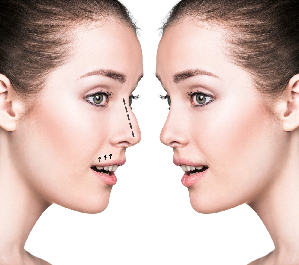 What To Expect From The Best Rhinoplasty Near Me - Infini Press